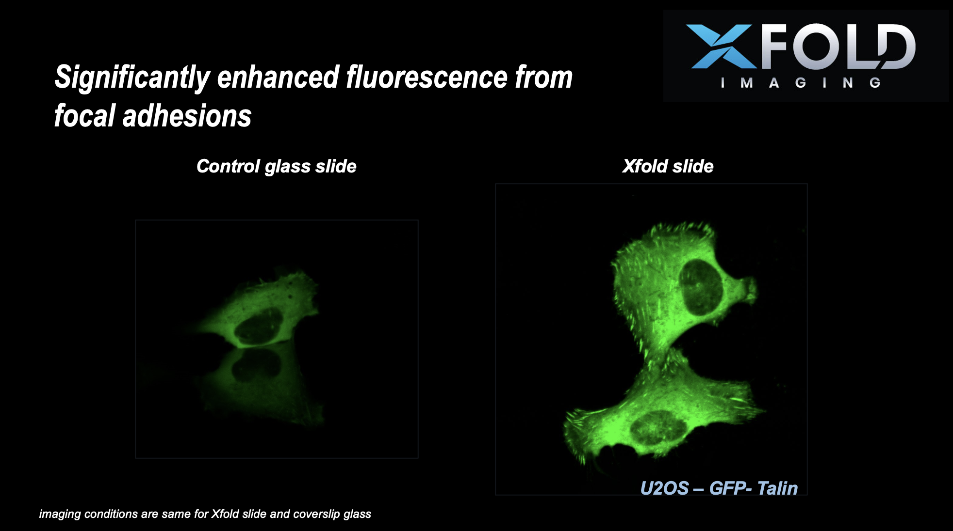 Xfold Imaging closed a seed round in January and targets to global markets